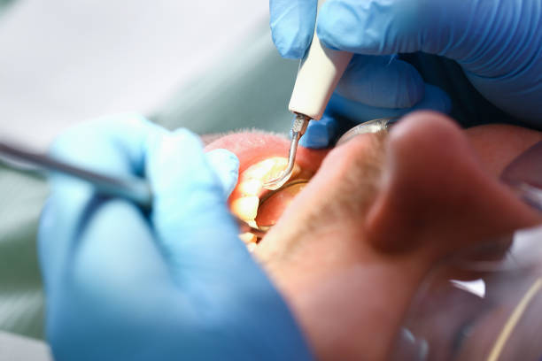 Best Emergency Treatment for Oral Infections in Aledo, TX