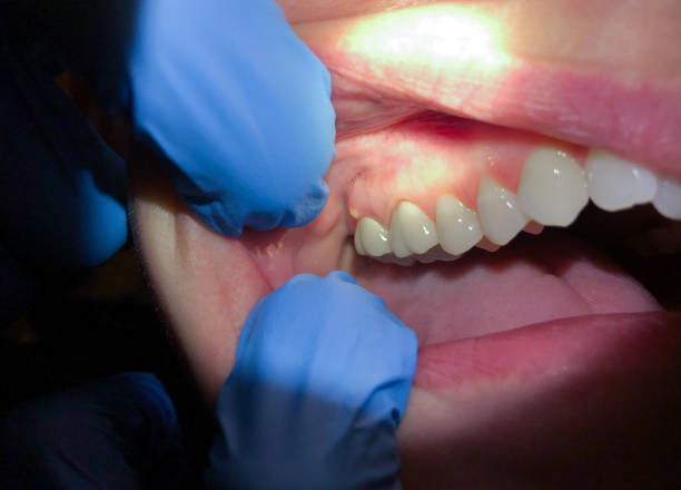 Best Emergency Dental Care for Sports Injuries in Aledo, TX