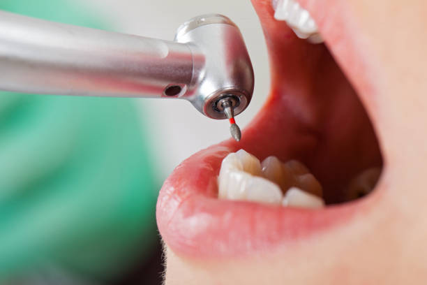 Best Emergency Treatment for Jaw Pain or Injury in Aledo, TX